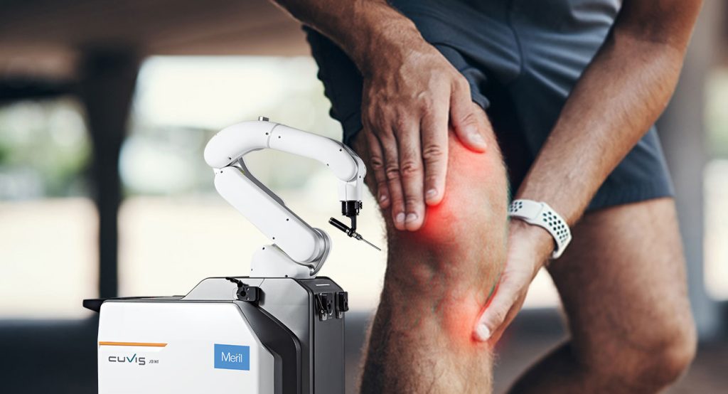 robotic knee replacement surgery