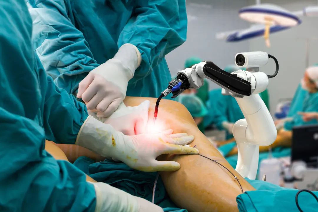 Robotic partial knee replacement in Mumbai