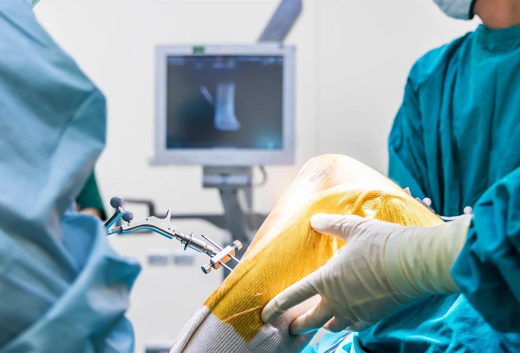 Robotic Knee Replacement Surgery in Mumbai