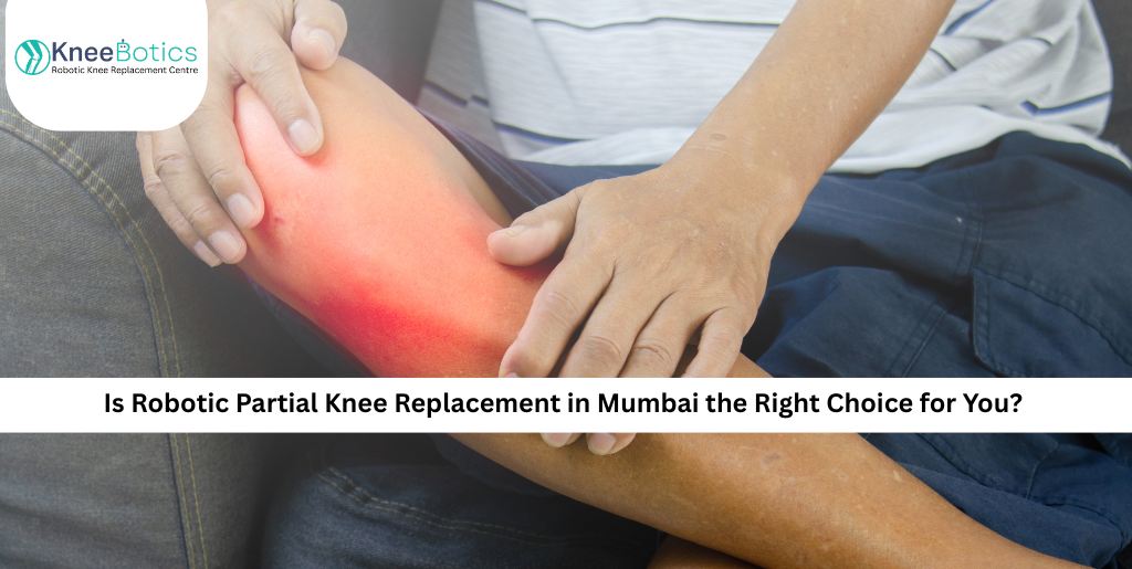 Robotic Partial Knee Replacement in Mumbai